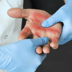 ACTUACIÓN DEL PROFESIONAL ANTE LESIONES POR AGENTES QUÍMICOS Y BIOLÓGICOS